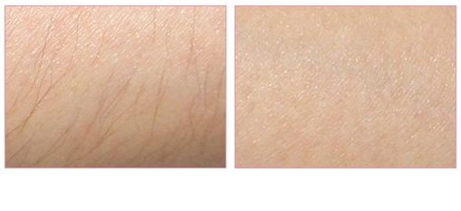 沈陽沈河盛京尚美醫(yī)療美容門診部值得信任嗎？當(dāng)?shù)鼐用駥ζ淇诒绾卧u價(jià)？