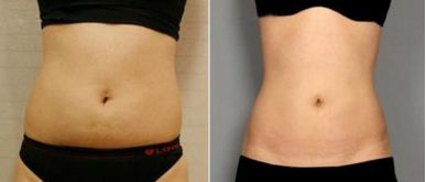 杭州最受推崇的整形醫(yī)院排行榜揭曉！頂級整容中心名單引領(lǐng)潮流，透視熱門手術(shù)Top10給你專業(yè)建議