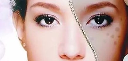 周一雄如何預(yù)約雙眼皮手術(shù)？案例分享與價(jià)格真實(shí)評(píng)估