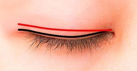 曹衛(wèi)剛修復雙眼皮技藝優(yōu)異，想知道他的專長嘛？進來看看吧！