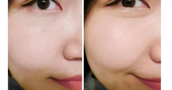 最佳專家推薦：成都五位頂級(jí)醫(yī)生精準(zhǔn)玻尿酸注射排行榜