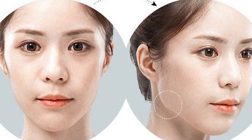 南京乳房美容醫(yī)院推薦，頂級(jí)醫(yī)療機(jī)構(gòu)推薦閱讀