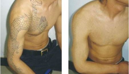 南昌紅谷灘區(qū)有什么好的整形美容醫(yī)院？