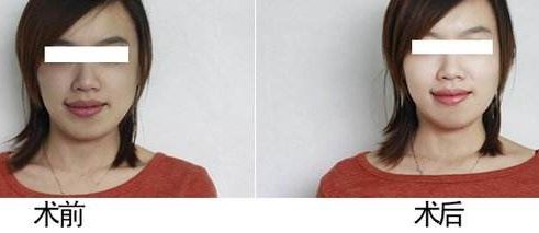 南漳縣人民醫(yī)院：二級(jí)甲等醫(yī)院，22個(gè)專(zhuān)業(yè)科室全面解讀