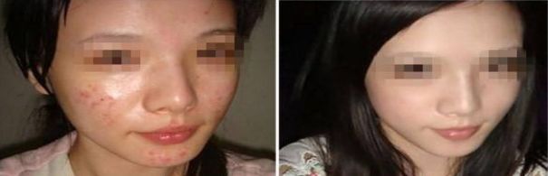 重慶近視手術醫(yī)院口碑大盤點：當?shù)厝苏鎸嵲u價