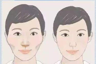 曼托與傲諾拉豐胸材料對比：功能與差異解析