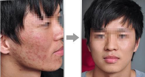 2024年南京整形醫(yī)院推薦：專業(yè)隆鼻哪家好？