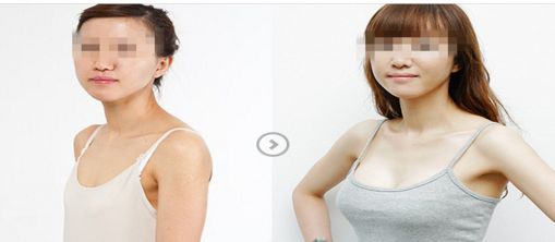 煙臺市醫(yī)美整形醫(yī)院綜合評測