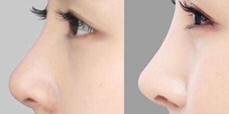 廣州隆胸修復(fù)有哪些值得信賴的醫(yī)院？豐滿胸部是否真的可行？