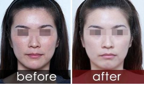 長沙亞太醫(yī)療美容，整形一家親