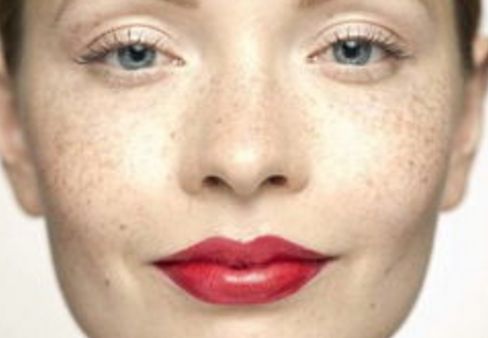 曙光整形醫(yī)院受追捧，隆鼻成功案例分享