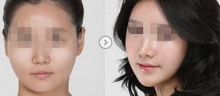 廣州整容醫(yī)院排行榜：查看比較好的吸脂治療醫(yī)院