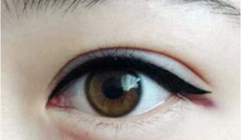 廣東做隆鼻哪家醫(yī)院的技術(shù)好？這五家公立醫(yī)院是值得一試的嗎？