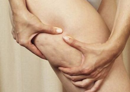 深圳哪家醫(yī)院拉皮手術(shù)效果好？專家推薦米蘭柏羽、美萊、藝星等醫(yī)院