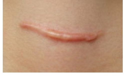 殷佳鵬整形醫(yī)生的技術(shù)與價格如何？