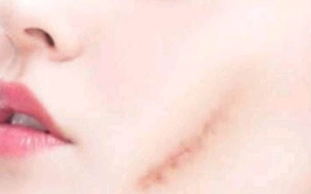 北京雙眼皮手術(shù)，牛人醫(yī)生排行揭秘