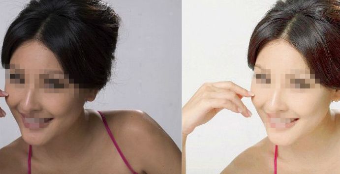 鄭州第二中醫(yī)院專家推薦：私密整形服務(wù)詳解，朱靜醫(yī)生實(shí)力解讀