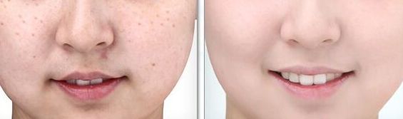 醫(yī)生工作室的預(yù)約方式介紹！蘇薇潔醫(yī)生眼整形工作室的成功案例展示！