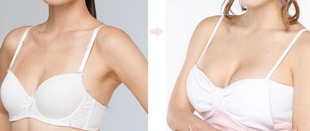 濟(jì)南第二人民醫(yī)院雙眼皮手術(shù)費(fèi)用和名醫(yī)推薦，有成功案例參考