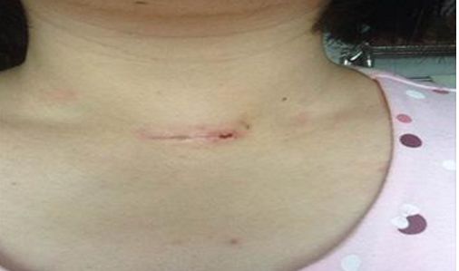 錦州附屬二院口腔修復(fù)科優(yōu)秀專家團(tuán)隊(duì)及種植牙成功案例匯總