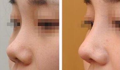 上海第九人民醫(yī)院乳房重塑的頂尖醫(yī)生有誰(shuí)？專家推薦+服務(wù)收費(fèi)參考