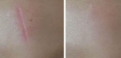 尋覓醫(yī)術(shù)出眾的武漢雙眼皮修復醫(yī)生，誰是不二之選？