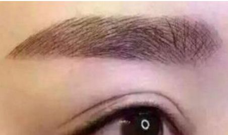 九院瞬間靚眼，告別上眼瞼下垂困擾，醫(yī)術(shù)專業(yè)獨(dú)具慧眼！