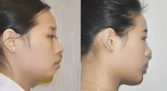 廣州私立整形醫(yī)院評價(jià)高的前三家推薦