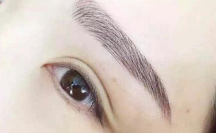 濟(jì)南諾德羅晉醫(yī)生帶給你的雙眼皮改變神奇嗎？這位頂級(jí)專家有著90天火爆案例展示！