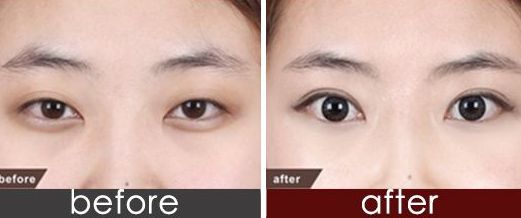 上海市九院品牌種植牙醫(yī)生推薦！頂尖口腔權(quán)威專(zhuān)家聯(lián)合推薦，價(jià)格一覽！