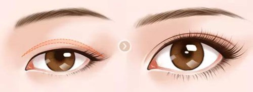 哈爾濱藝星整形醫(yī)院醫(yī)術(shù)如何優(yōu)勢(shì)明顯？技術(shù)能否滿足醫(yī)美需求？