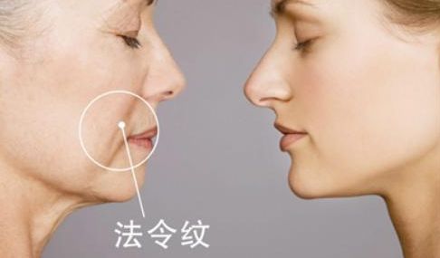 武漢雙眼皮醫(yī)生哪些技術(shù)強？陳宏案例揭秘前五強！