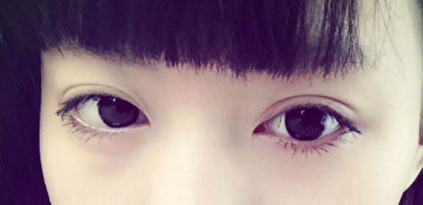 靠前重慶眼部整形醫(yī)院榜單出爐，時(shí)光整形受認(rèn)可