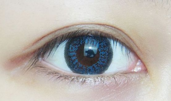 昆明哪家醫(yī)院更適合割雙眼皮