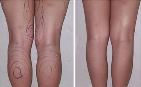 廣東省整形醫(yī)院新聲，權(quán)威排名榜單曝光