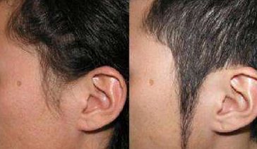 北京輕醫(yī)美整形醫(yī)院推薦，微整形首選！