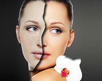 北京整形醫(yī)院哪家隆胸效果最佳