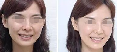 佛山哪家整形醫(yī)院超好的，超皮秒技術(shù)厲害的名單公布