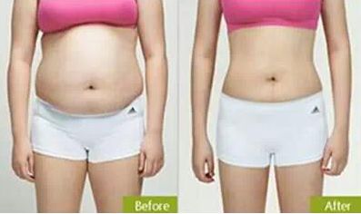 上海優(yōu)質(zhì)的脂肪填充醫(yī)院哪家好？網(wǎng)友青睞排行前五強(qiáng)