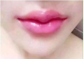 沈陽(yáng)改善鼻形效果的專(zhuān)業(yè)醫(yī)院有哪些？全新排名最新發(fā)布，值得收藏參考