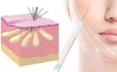 武漢仁愛時(shí)光吸脂手術(shù)優(yōu)質(zhì)可靠嗎？它有哪些優(yōu)點(diǎn)？