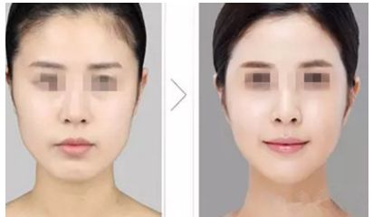 廣東哪家整形醫(yī)院醫(yī)師團隊強大？筆者推薦廣東省人民醫(yī)院整形外科