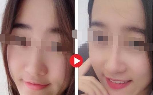 【2024年】蘇州哪家整形醫(yī)院口碑最好？評(píng)選出的前三強(qiáng)！