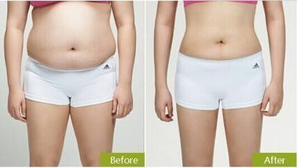 廣州雙眼皮整形醫(yī)院排名前十榜單已定！難道紫馨和軍美是口碑比較好的選擇？