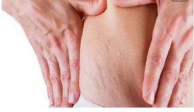 重慶亞美醫(yī)院楊武林醫(yī)生的眼部手術(shù)效果如何？