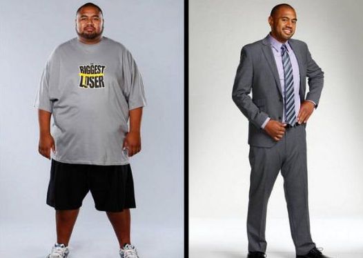 上海九院激光脫毛價(jià)格資訊，推薦專家選擇