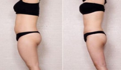 深圳最新刷新！這些除皺醫(yī)院排行榜上名列前茅！