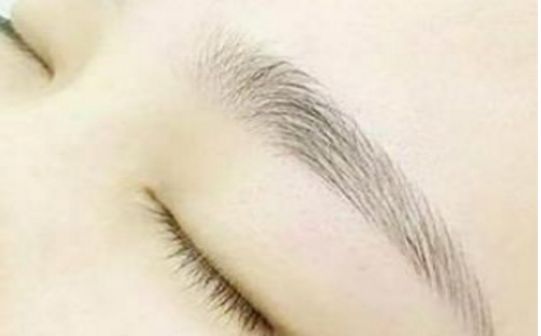 樂山市人民醫(yī)院中瞇眼袋手術談何效果？眼袋修復專家醫(yī)師及成功案例分享