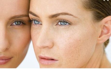 成都當(dāng)?shù)孛廊菡吾t(yī)院鼻部整形效果如何？真實(shí)案例發(fā)布！