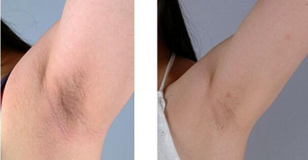 2023長春市中心醫(yī)院整形外科價(jià)格如何？【宋彬】醫(yī)生經(jīng)驗(yàn)分享真可信嗎？